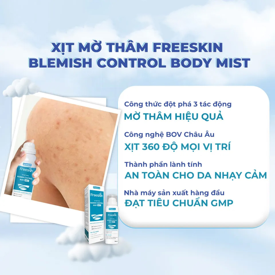 Xịt Mờ Thâm Freeskin Blemish Control Body Mist Giúp Giảm Thâm Mụn Lưng & Làm Đều Màu Da Sau Mụn 80ml
