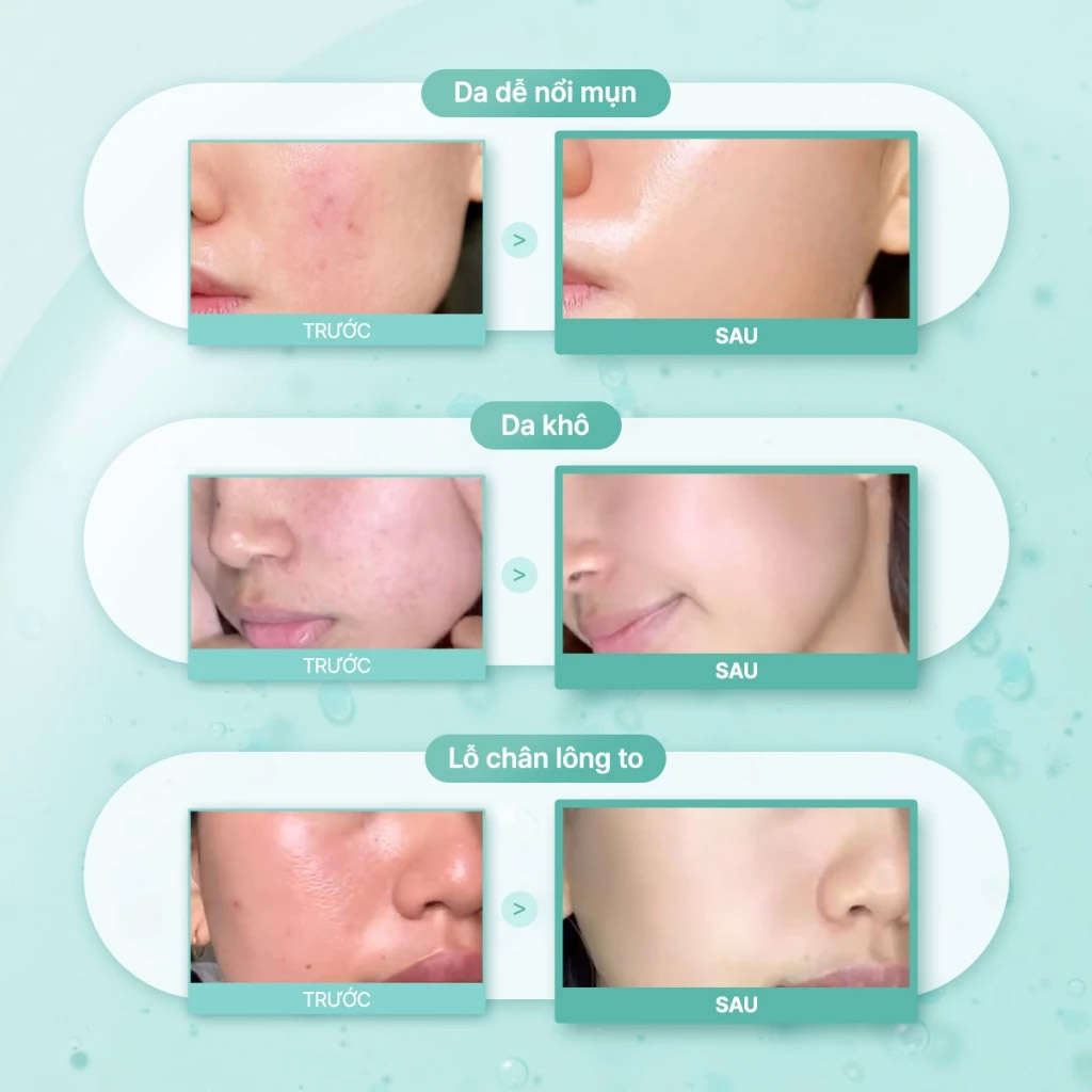 Tinh Chất Some By Mi Pdrn Spirulina Soothing Repair Serum 50ml