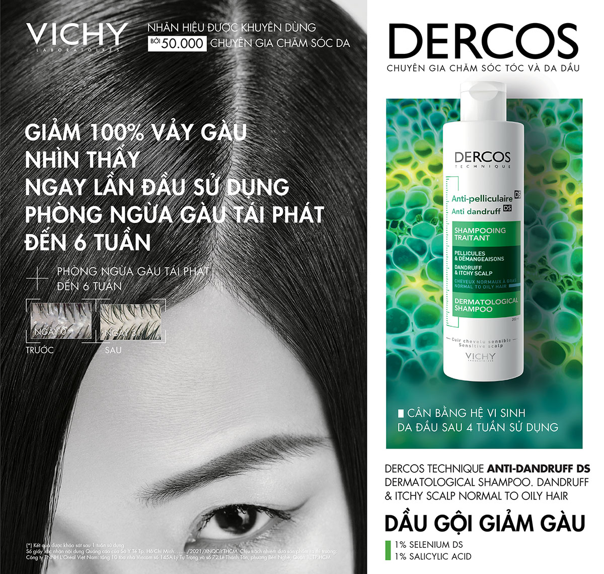 Vichy Dercos Shampoo Dandruff &&.,& Itchy Scalp 200ml